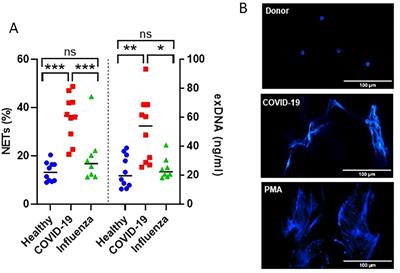 Glycosylation signature of plasma IgA of critically ill COVID-19 patients